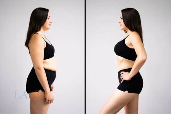 LA-EMS Body Sculpting Beaconsfield results before and after of womans results on body toning.