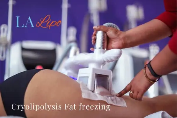 women getting fat freezing Beaconsfield