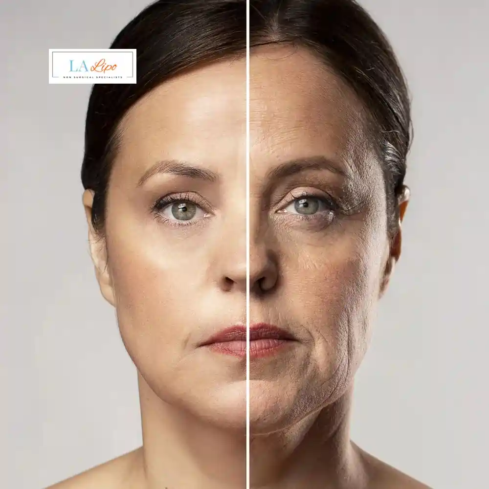 How Can You Tell If Non-Surgical Skin Tightening Is Right for You Beaconsfield?