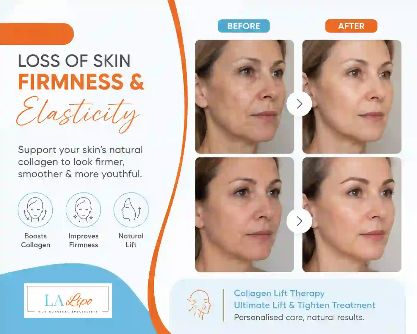 Sign #7: Loss of Skin Firmness and Elasticity Beaconsfield
