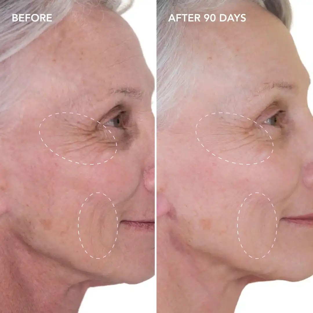 When will you see results Beaconsfield
